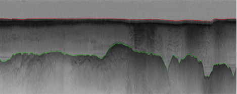 PolarGrid Image Processing